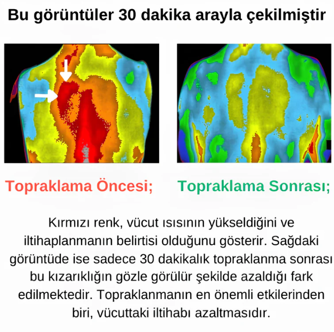 Comfora Topraklama Çarşafı
